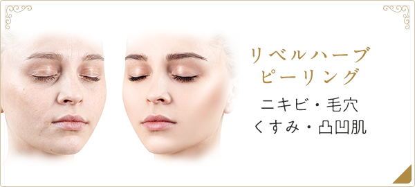 リベルハーブピーリング